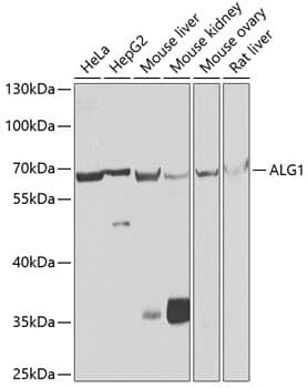 Western Blot: ALG1 Antibody [NBP3-38470] - Western blot analysis of various lysates using ALG1 Rabbit pAb at 1:1000 dilution.Secondary antibody: HRP-conjugated Goat anti-Rabbit IgG (H+L) at 1:10000 dilution.Lysates/proteins: 25ug per lane.Blocking buffer: 3% nonfat dry milk in TBST.Detection: ECL Basic Kit.Exposure time: 30s.