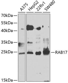 Western Blot: Rab17 Antibody [NBP3-38471] - Western blot analysis of various lysates using Rab17 Rabbit pAb at 1:1000 dilution.Secondary antibody: HRP-conjugated Goat anti-Rabbit IgG (H+L) at 1:10000 dilution.Lysates/proteins: 25ug per lane.Blocking buffer: 3% nonfat dry milk in TBST.Detection: ECL Basic Kit.Exposure time: 90s.