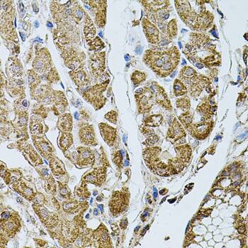 Immunohistochemistry CHRFAM7A Antibody