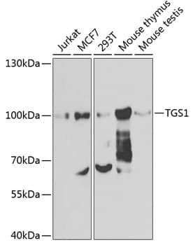 Western Blot: PIMT Antibody [NBP3-38476] - Western blot analysis of various lysates using PIMT Rabbit pAb at 1:1000 dilution.Secondary antibody: HRP-conjugated Goat anti-Rabbit IgG (H+L) at 1:10000 dilution.Lysates/proteins: 25ug per lane.Blocking buffer: 3% nonfat dry milk in TBST.Detection: ECL Basic Kit.Exposure time: 90s.