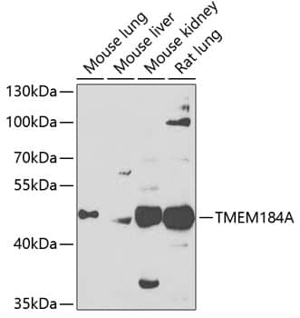 Western Blot: TMEM184A Antibody [NBP3-38477] - Western blot analysis of various lysates using TMEM184A Rabbit pAb at 1:1000 dilution.Secondary antibody: HRP-conjugated Goat anti-Rabbit IgG (H+L) at 1:10000 dilution.Lysates/proteins: 25ug per lane.Blocking buffer: 3% nonfat dry milk in TBST.Detection: ECL Enhanced Kit.Exposure time: 90s.