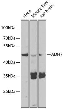 Western Blot: alcohol dehydrogenase 7 Antibody [NBP3-38478] - Western blot analysis of various lysates using alcohol dehydrogenase 7 Rabbit pAb at 1:1000 dilution.Secondary antibody: HRP-conjugated Goat anti-Rabbit IgG (H+L) at 1:10000 dilution.Lysates/proteins: 25ug per lane.Blocking buffer: 3% nonfat dry milk in TBST.Detection: ECL Basic Kit.Exposure time: 5s.