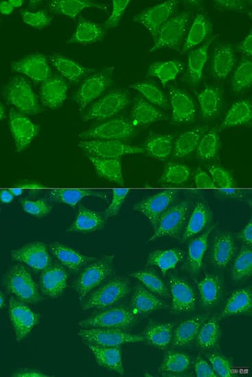 Immunocytochemistry/ Immunofluorescence alcohol dehydrogenase 7 Antibody