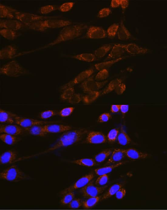 Immunocytochemistry/ Immunofluorescence: Dynamin 2 Antibody [NBP3-38480] - Immunofluorescence analysis of NIH-3T3 cells using Dynamin 2 Rabbit pAb at dilution of 1:100 (40x lens). Secondary antibody: Cy3-conjugated Goat anti-Rabbit IgG (H+L) at 1:500 dilution. Blue: DAPI for nuclear staining.