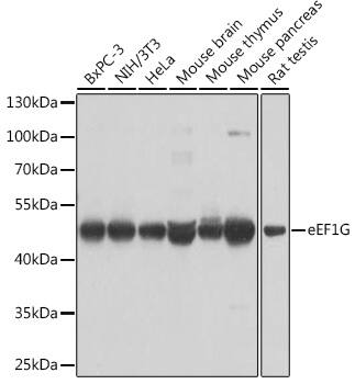 Western Blot: EEF1G Antibody [NBP3-38481] - Western blot analysis of various lysates using EEF1G Rabbit pAb at 1:1000 dilution.Secondary antibody: HRP-conjugated Goat anti-Rabbit IgG (H+L) at 1:10000 dilution.Lysates/proteins: 25ug per lane.Blocking buffer: 3% nonfat dry milk in TBST.Detection: ECL Basic Kit.Exposure time: 5s.