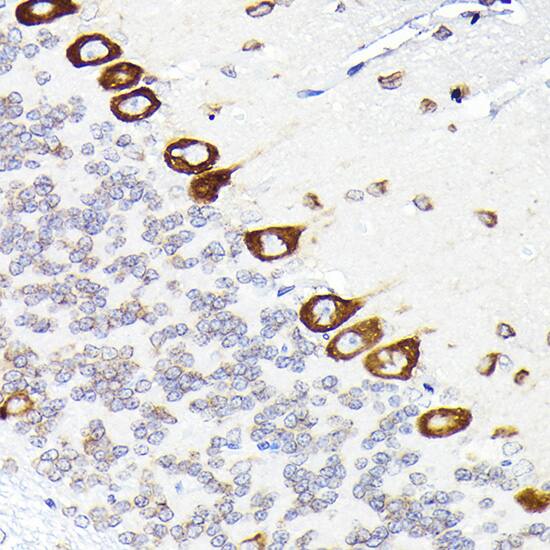 Immunohistochemistry: EEF1G Antibody [NBP3-38481] - Immunohistochemistry analysis of paraffin-embedded Rat brain using EEF1G Rabbit pAb at dilution of 1:50 (40x lens). High pressure antigen retrieval performed with 0.01M Citrate Bufferr (pH 6.0) prior to IHC staining.