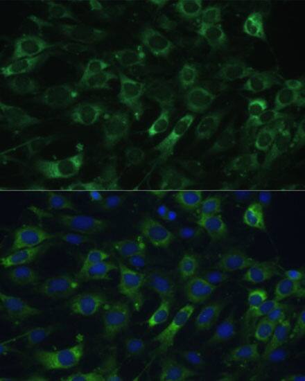 Immunocytochemistry/ Immunofluorescence: EEF1G Antibody [NBP3-38481] - Immunofluorescence analysis of C6 cells using EEF1G Rabbit pAb at dilution of 1:100 (40x lens). Secondary antibody: Cy3-conjugated Goat anti-Rabbit IgG (H+L) at 1:500 dilution. Blue: DAPI for nuclear staining.