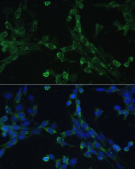 Immunocytochemistry/ Immunofluorescence: EEF1G Antibody [NBP3-38481] - Immunofluorescence analysis of NIH-3T3 cells using EEF1G Rabbit pAb at dilution of 1:100 (40x lens). Secondary antibody: Cy3-conjugated Goat anti-Rabbit IgG (H+L) at 1:500 dilution. Blue: DAPI for nuclear staining.