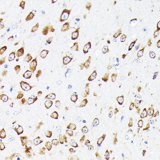 Immunohistochemistry: EEF1G Antibody [NBP3-38481] - Immunohistochemistry analysis of paraffin-embedded Mouse brain using EEF1G Rabbit pAb at dilution of 1:50 (40x lens). High pressure antigen retrieval performed with 0.01M Citrate Bufferr (pH 6.0) prior to IHC staining.