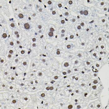 Immunohistochemistry: TFII-I Antibody [NBP3-38482] - Immunohistochemistry analysis of paraffin-embedded Mouse liver using TFII-I Rabbit pAb (40x lens). Microwave antigen retrieval performed with 0.01M PBS Buffer (pH 7.2) prior to IHC staining.