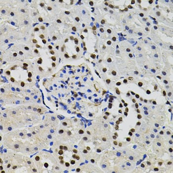 Immunohistochemistry: TFII-I Antibody [NBP3-38482] - Immunohistochemistry analysis of paraffin-embedded Rat kidney using TFII-I Rabbit pAb (40x lens). Microwave antigen retrieval performed with 0.01M PBS Buffer (pH 7.2) prior to IHC staining.