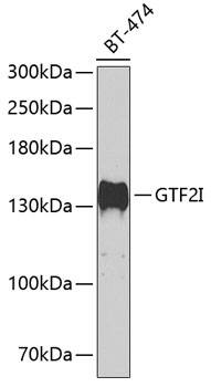 Western Blot: TFII-I Antibody [NBP3-38482] - Western blot analysis of lysates from BT-474 cells, using TFII-I Rabbit pAb at 1:500 dilution.Secondary antibody: HRP-conjugated Goat anti-Rabbit IgG (H+L) at 1:10000 dilution.Lysates/proteins: 25ug per lane.Blocking buffer: 3% nonfat dry milk in TBST.Detection: ECL Basic Kit.Exposure time: 90s.