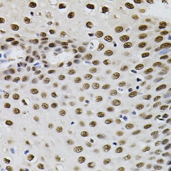 Immunohistochemistry: TFII-I Antibody [NBP3-38482] - Immunohistochemistry analysis of paraffin-embedded Human esophagus using TFII-I Rabbit pAb (40x lens). Microwave antigen retrieval performed with 0.01M PBS Buffer (pH 7.2) prior to IHC staining.