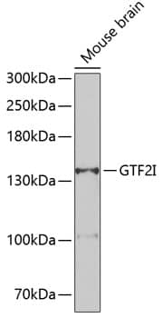 Western Blot: TFII-I Antibody [NBP3-38482] - Western blot analysis of lysates from mouse brain, using TFII-I Rabbit pAb at 1:500 dilution.Secondary antibody: HRP-conjugated Goat anti-Rabbit IgG (H+L) at 1:10000 dilution.Lysates/proteins: 25ug per lane.Blocking buffer: 3% nonfat dry milk in TBST.Detection: ECL Enhanced Kit.Exposure time: 90s.