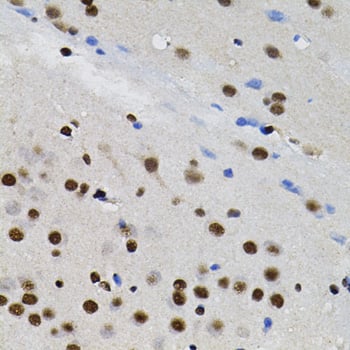 Immunohistochemistry: TFII-I Antibody [NBP3-38482] - Immunohistochemistry analysis of paraffin-embedded Rat brain using TFII-I Rabbit pAb (40x lens). Microwave antigen retrieval performed with 0.01M PBS Buffer (pH 7.2) prior to IHC staining.