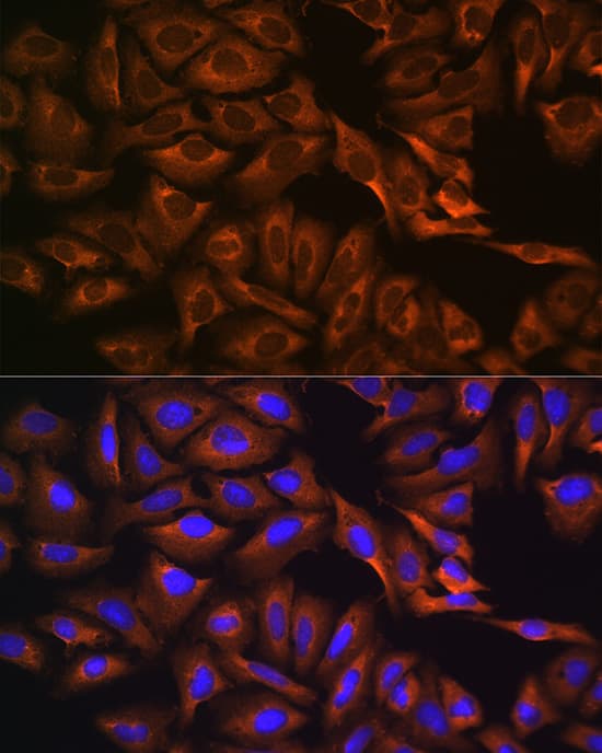 Immunocytochemistry/ Immunofluorescence: GPIP137 Antibody [NBP3-38483] - Immunofluorescence analysis of U-2 OS cells using GPIP137 Rabbit pAb at dilution of 1:100 (40x lens). Secondary antibody: Cy3-conjugated Goat anti-Rabbit IgG (H+L) at 1:500 dilution. Blue: DAPI for nuclear staining.