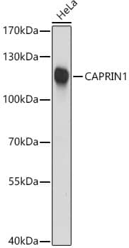 Western Blot: GPIP137 Antibody [NBP3-38483] - Western blot analysis of lysates from HeLa cells, using GPIP137 Rabbit pAb at 1:3000 dilution.Secondary antibody: HRP-conjugated Goat anti-Rabbit IgG (H+L) at 1:10000 dilution.Lysates/proteins: 25ug per lane.Blocking buffer: 3% nonfat dry milk in TBST.Detection: ECL Basic Kit.Exposure time: 10s.