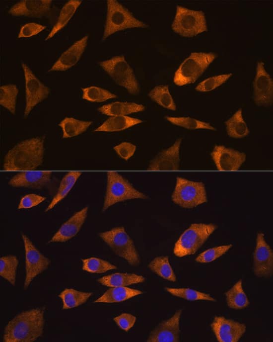 Immunocytochemistry/ Immunofluorescence: GPIP137 Antibody [NBP3-38483] - Immunofluorescence analysis of L929 cells using GPIP137 Rabbit pAb at dilution of 1:100 (40x lens). Secondary antibody: Cy3-conjugated Goat anti-Rabbit IgG (H+L) at 1:500 dilution. Blue: DAPI for nuclear staining.