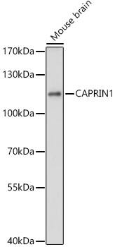 Western Blot: GPIP137 Antibody [NBP3-38483] - Western blot analysis of lysates from Mouse brain, using GPIP137 Rabbit pAb at 1:3000 dilution.Secondary antibody: HRP-conjugated Goat anti-Rabbit IgG (H+L) at 1:10000 dilution.Lysates/proteins: 25ug per lane.Blocking buffer: 3% nonfat dry milk in TBST.Detection: ECL Basic Kit.Exposure time: 30s.