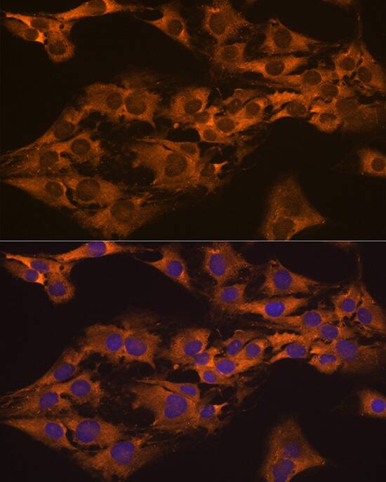 Immunocytochemistry/ Immunofluorescence: GPIP137 Antibody [NBP3-38483] - Immunofluorescence analysis of C6 cells using GPIP137 Rabbit pAb at dilution of 1:100 (40x lens). Secondary antibody: Cy3-conjugated Goat anti-Rabbit IgG (H+L) at 1:500 dilution. Blue: DAPI for nuclear staining.