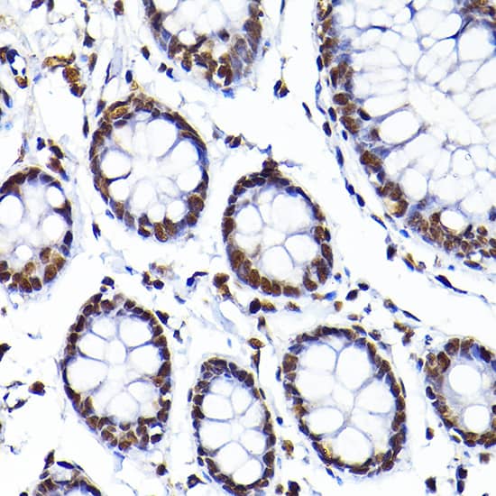 Immunohistochemistry: SAFB Antibody [NBP3-38485] - Immunohistochemistry analysis of paraffin-embedded Human colon using SAFB Rabbit pAb at dilution of 1:200 (40x lens). High pressure antigen retrieval performed with 0.01M Citrate Bufferr (pH 6.0) prior to IHC staining.