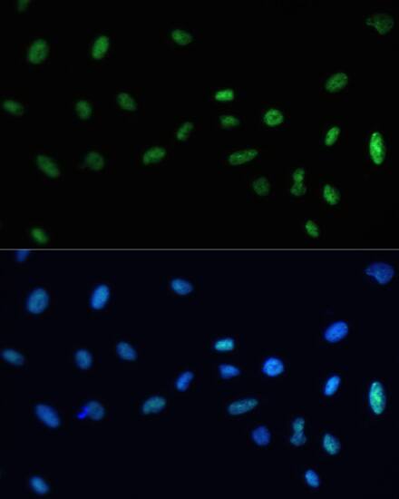 Immunocytochemistry/ Immunofluorescence: SAFB Antibody [NBP3-38485] - Immunofluorescence analysis of U-2 OS cells using SAFB Rabbit pAb at dilution of 1:100. Secondary antibody: Cy3-conjugated Goat anti-Rabbit IgG (H+L) at 1:500 dilution. Blue: DAPI for nuclear staining.