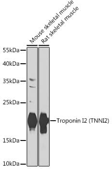 Western Blot: Troponin I type 2 (fast skeletal) Antibody [NBP3-38486] - Western blot analysis of various lysates using Troponin I type 2 (fast skeletal)(TNNI2) Rabbit pAb at 1:1000 dilution.Secondary antibody: HRP-conjugated Goat anti-Rabbit IgG (H+L) at 1:10000 dilution.Lysates/proteins: 25ug per lane.Blocking buffer: 3% nonfat dry milk in TBST.Detection: ECL Basic Kit.Exposure time: 30s.