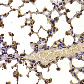 Immunohistochemistry: WHSC1 Antibody [NBP3-38487] - Immunohistochemistry analysis of paraffin-embedded Mouse lung using WHSC1 Rabbit pAb at dilution of 1:100 (40x lens). Microwave antigen retrieval performed with 0.01M PBS Buffer (pH 7.2) prior to IHC staining.