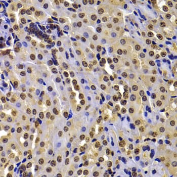 Immunohistochemistry: WHSC1 Antibody [NBP3-38487] - Immunohistochemistry analysis of paraffin-embedded Mouse kidney using WHSC1 Rabbit pAb at dilution of 1:100 (40x lens). Microwave antigen retrieval performed with 0.01M PBS Buffer (pH 7.2) prior to IHC staining.