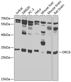 Western Blot: ORC6L Antibody [NBP3-38489] - Western blot analysis of various lysates using ORC6L Rabbit pAb at 1:1000 dilution.Secondary antibody: HRP-conjugated Goat anti-Rabbit IgG (H+L) at 1:10000 dilution.Lysates/proteins: 25ug per lane.Blocking buffer: 3% nonfat dry milk in TBST.Detection: ECL Basic Kit.Exposure time: 30s.