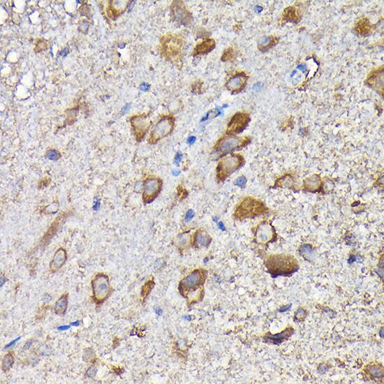 Immunohistochemistry: MTHFD1L Antibody [NBP3-38490] - Immunohistochemistry analysis of paraffin-embedded Mouse spinal cord using MTHFD1L Rabbit pAb at dilution of 1:200 (40x lens). High pressure antigen retrieval performed with 0.01M Citrate Bufferr (pH 6.0) prior to IHC staining.