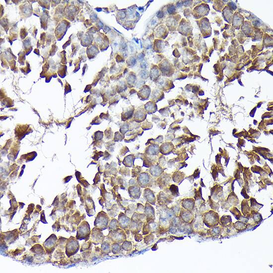 Immunohistochemistry: MTHFD1L Antibody [NBP3-38490] - Immunohistochemistry analysis of paraffin-embedded Mouse testis using MTHFD1L Rabbit pAb at dilution of 1:200 (40x lens). High pressure antigen retrieval performed with 0.01M Citrate Bufferr (pH 6.0) prior to IHC staining.