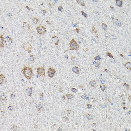 Immunohistochemistry: MTHFD1L Antibody [NBP3-38490] - Immunohistochemistry analysis of paraffin-embedded Rat brain using MTHFD1L Rabbit pAb at dilution of 1:200 (40x lens). High pressure antigen retrieval performed with 0.01M Citrate Bufferr (pH 6.0) prior to IHC staining.
