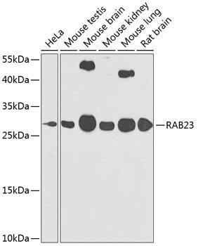 Western Blot: RAB23 Antibody [NBP3-38491] - Western blot analysis of various lysates using RAB23 Rabbit pAb at 1:1000 dilution.Secondary antibody: HRP-conjugated Goat anti-Rabbit IgG (H+L) at 1:10000 dilution.Lysates/proteins: 25ug per lane.Blocking buffer: 3% nonfat dry milk in TBST.Detection: ECL Basic Kit.Exposure time: 90s.