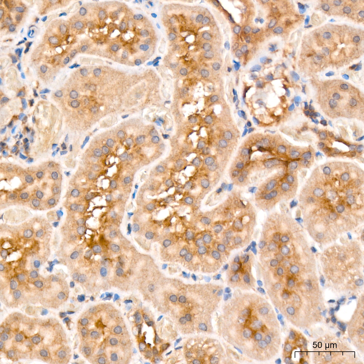 Immunohistochemistry: MCCC2 Antibody [NBP3-38493] - Immunohistochemistry analysis of MCCC2 in paraffin-embedded mouse kidney tissue using MCCC2 Rabbit pAb at a dilution of 1:200 (40x lens). High pressure antigen retrieval was performed with 0.01 M citrate buffer (pH 6.0) prior to IHC staining.
