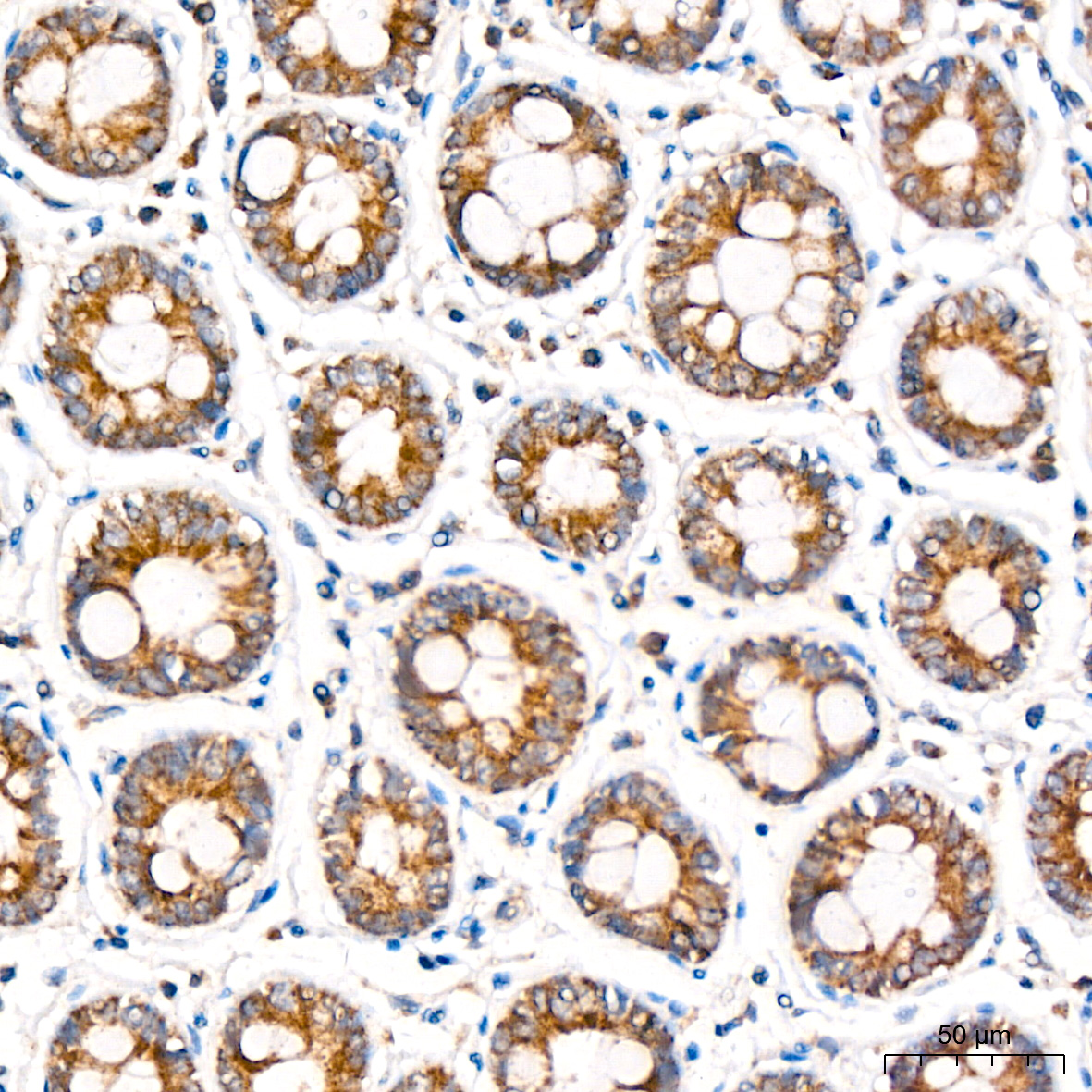 Immunohistochemistry: MCCC2 Antibody [NBP3-38493] - Immunohistochemistry analysis of MCCC2 in paraffin-embedded human colon tissue using MCCC2 Rabbit pAb at a dilution of 1:200 (40x lens). High pressure antigen retrieval was performed with 0.01 M citrate buffer (pH 6.0) prior to IHC staining.
