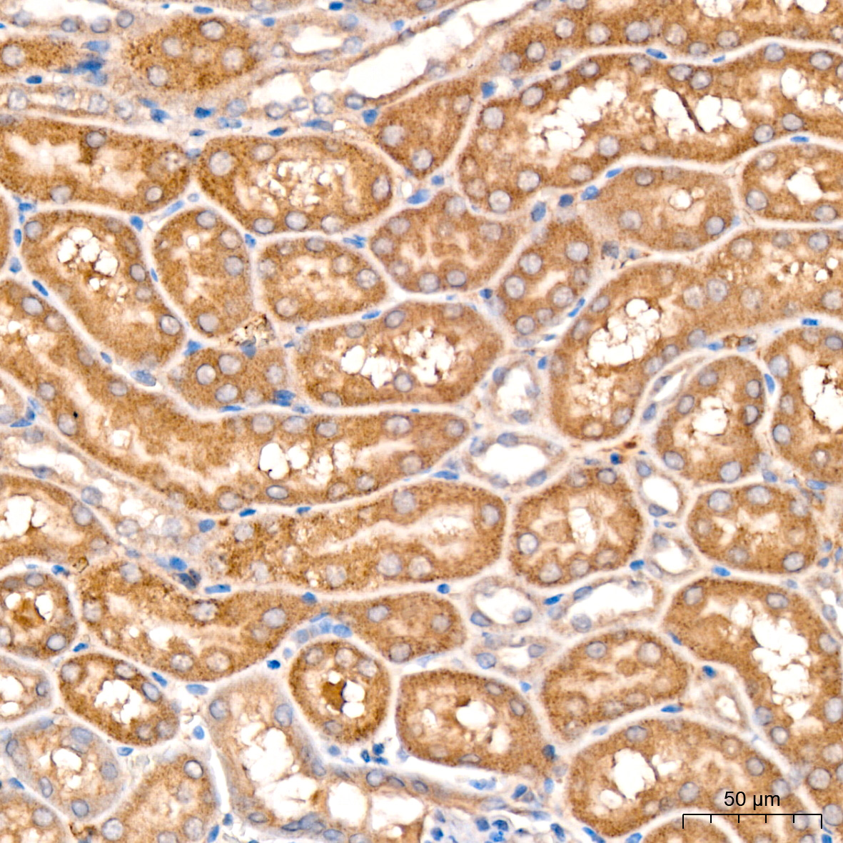 Immunohistochemistry: MCCC2 Antibody [NBP3-38493] - Immunohistochemistry analysis of MCCC2 in paraffin-embedded rat kidney tissue using MCCC2 Rabbit pAb at a dilution of 1:200 (40x lens). High pressure antigen retrieval was performed with 0.01 M citrate buffer (pH 6.0) prior to IHC staining.