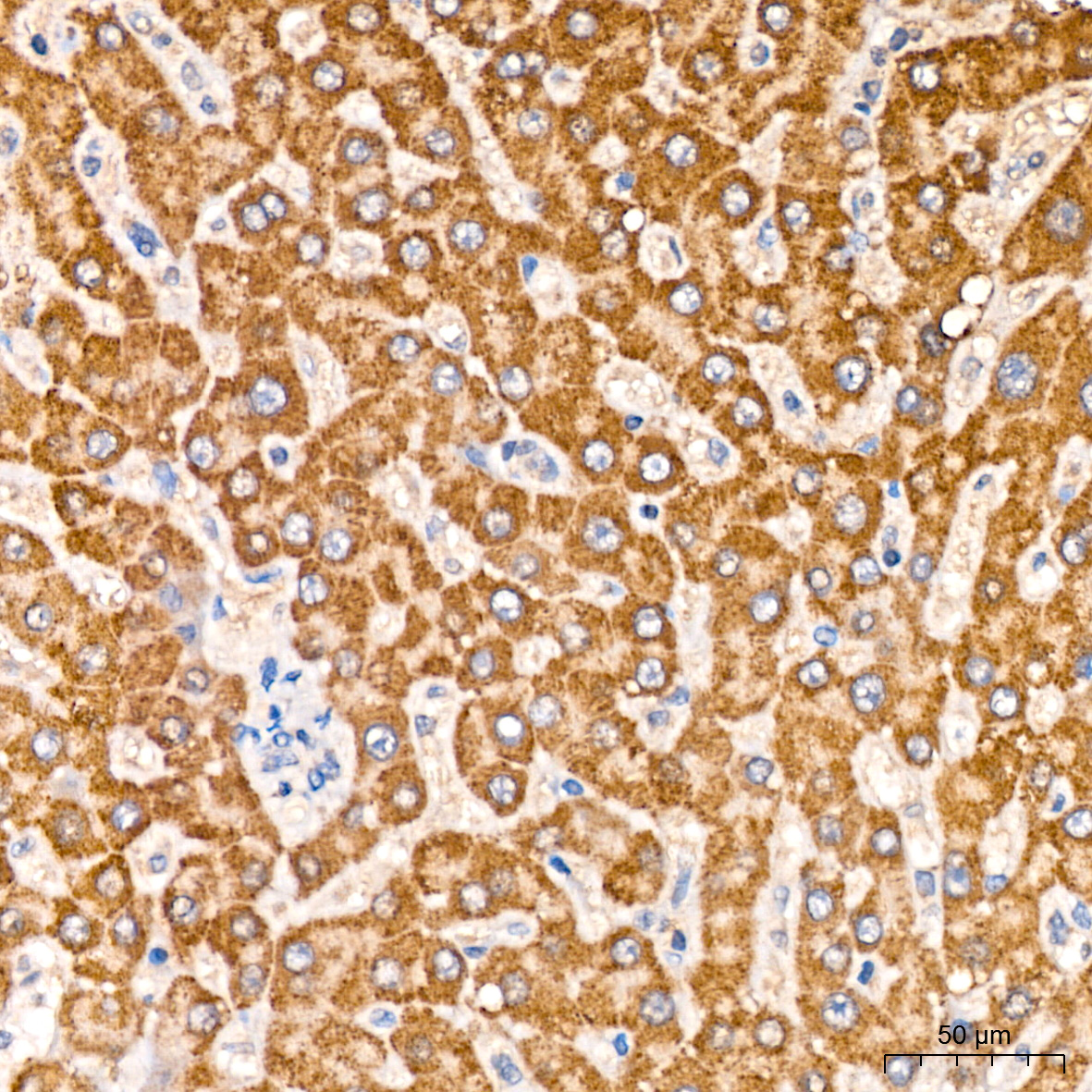 Immunohistochemistry: MCCC2 Antibody [NBP3-38493] - Immunohistochemistry analysis of MCCC2 in paraffin-embedded human liver tissue using MCCC2 Rabbit pAb at a dilution of 1:200 (40x lens). High pressure antigen retrieval was performed with 0.01 M citrate buffer (pH 6.0) prior to IHC staining.