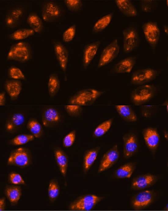 Immunocytochemistry/ Immunofluorescence: GRID1 Antibody [NBP3-38495] - Immunofluorescence analysis of L929 cells using GRID1 Rabbit pAb at dilution of 1:100 (40x lens). Secondary antibody: Cy3-conjugated Goat anti-Rabbit IgG (H+L) at 1:500 dilution. Blue: DAPI for nuclear staining.