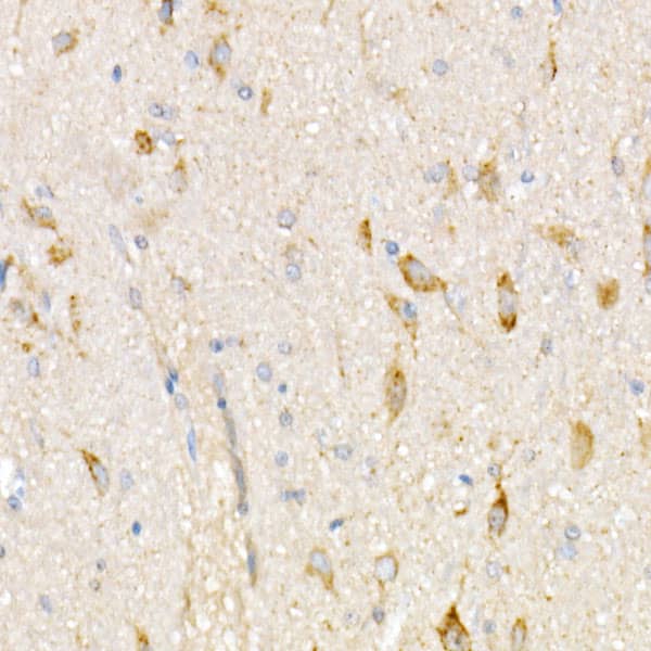 Immunohistochemistry: NDUFV1 Antibody [NBP3-38496] - Immunohistochemistry analysis of paraffin-embedded Rat brain using NDUFV1 Rabbit pAb at dilution of 1:20 (40x lens). High pressure antigen retrieval performed with 0.01M Citrate Bufferr (pH 6.0) prior to IHC staining.