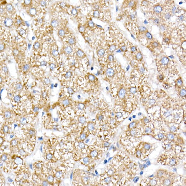 Immunohistochemistry: NDUFV1 Antibody [NBP3-38496] - Immunohistochemistry analysis of paraffin-embedded Human liver using NDUFV1 Rabbit pAb at dilution of 1:20 (40x lens). High pressure antigen retrieval performed with 0.01M Citrate Bufferr (pH 6.0) prior to IHC staining.