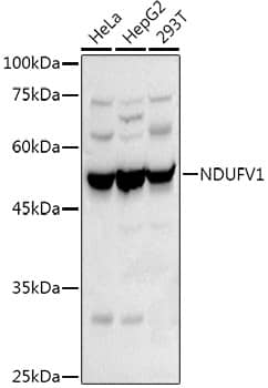 Western Blot: NDUFV1 Antibody [NBP3-38496] - Western blot analysis of various lysates using NDUFV1 Rabbit pAb at 1:500 dilution.Secondary antibody: HRP-conjugated Goat anti-Rabbit IgG (H+L) at 1:10000 dilution.Lysates/proteins: 25ug per lane.Blocking buffer: 3% nonfat dry milk in TBST.Detection: ECL Basic Kit.Exposure time: 30s.