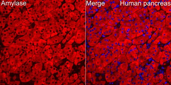 Immunocytochemistry/ Immunofluorescence: Pancreatic Amylase Alpha Antibody [NBP3-38499] - Immunofluorescence analysis of paraffin-embedded human pancreas using Pancreatic Amylase Alpha Rabbit pAb at dilution of 1:100 (40x lens). Secondary antibody: Cy3 Goat Anti-Rabbit IgG (H+L) at 1:500 dilution. Blue: DAPI for nuclear staining.