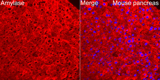 Immunocytochemistry/ Immunofluorescence: Pancreatic Amylase Alpha Antibody [NBP3-38499] - Immunofluorescence analysis of paraffin-embedded mouse pancreas using Pancreatic Amylase Alpha Rabbit pAb at dilution of 1:100 (40x lens). Secondary antibody: Cy3 Goat Anti-Rabbit IgG (H+L) at 1:500 dilution. Blue: DAPI for nuclear staining.