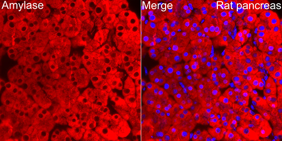 Immunocytochemistry/ Immunofluorescence: Pancreatic Amylase Alpha Antibody [NBP3-38499] - Immunofluorescence analysis of paraffin-embedded rat pancreas using Pancreatic Amylase Alpha Rabbit pAb at dilution of 1:100 (40x lens). Secondary antibody: Cy3 Goat Anti-Rabbit IgG (H+L) at 1:500 dilution. Blue: DAPI for nuclear staining.