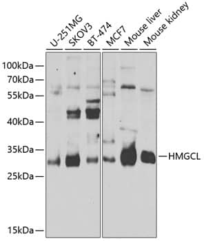 Western Blot: HMGCL Antibody [NBP3-38500] - Western blot analysis of various lysates using HMGCL Rabbit pAb at 1:1000 dilution.Secondary antibody: HRP-conjugated Goat anti-Rabbit IgG (H+L) at 1:10000 dilution.Lysates/proteins: 25ug per lane.Blocking buffer: 3% nonfat dry milk in TBST.Detection: ECL Enhanced Kit.Exposure time: 15s.