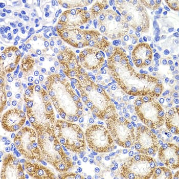 Immunohistochemistry: HMGCL Antibody [NBP3-38500] - Immunohistochemistry analysis of paraffin-embedded Rat kidney using HMGCL Rabbit pAb at dilution of 1:100 (40x lens). Microwave antigen retrieval performed with 0.01M PBS Buffer (pH 7.2) prior to IHC staining.