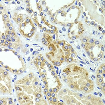 Immunohistochemistry: HMGCL Antibody [NBP3-38500] - Immunohistochemistry analysis of paraffin-embedded Human kidney using HMGCL Rabbit pAb at dilution of 1:100 (40x lens). Microwave antigen retrieval performed with 0.01M PBS Buffer (pH 7.2) prior to IHC staining.