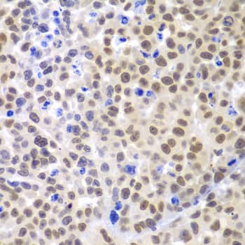 Immunohistochemistry Lhx4 Antibody