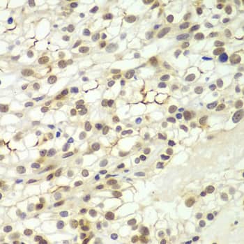 Immunohistochemistry Lhx4 Antibody